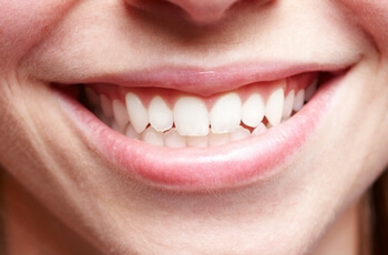 Beautiful smile